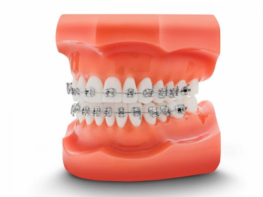 MIM bondable standard bracket ROTH 0.022 with 345#; UR1 image