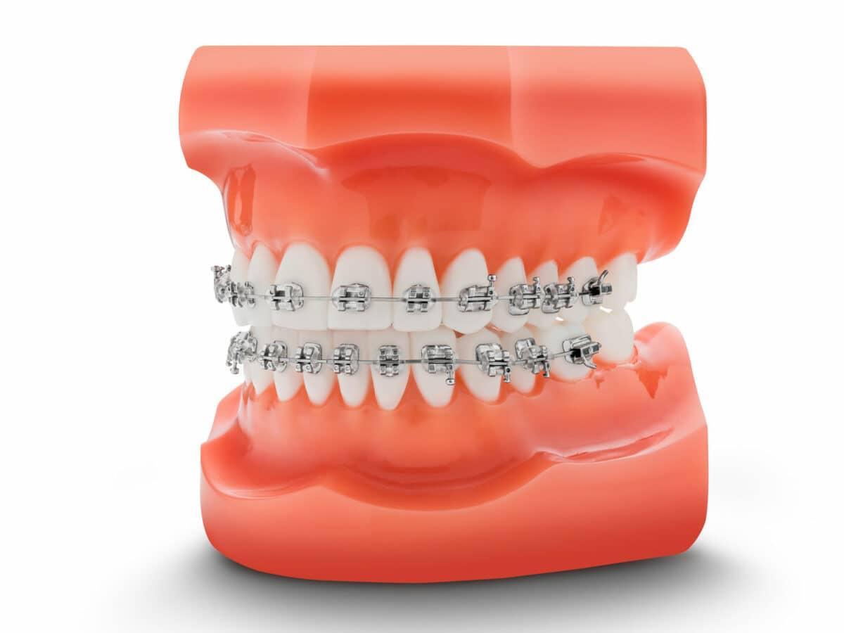 Orthodontisch background img